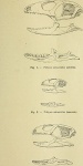 Hemisphaeriodon